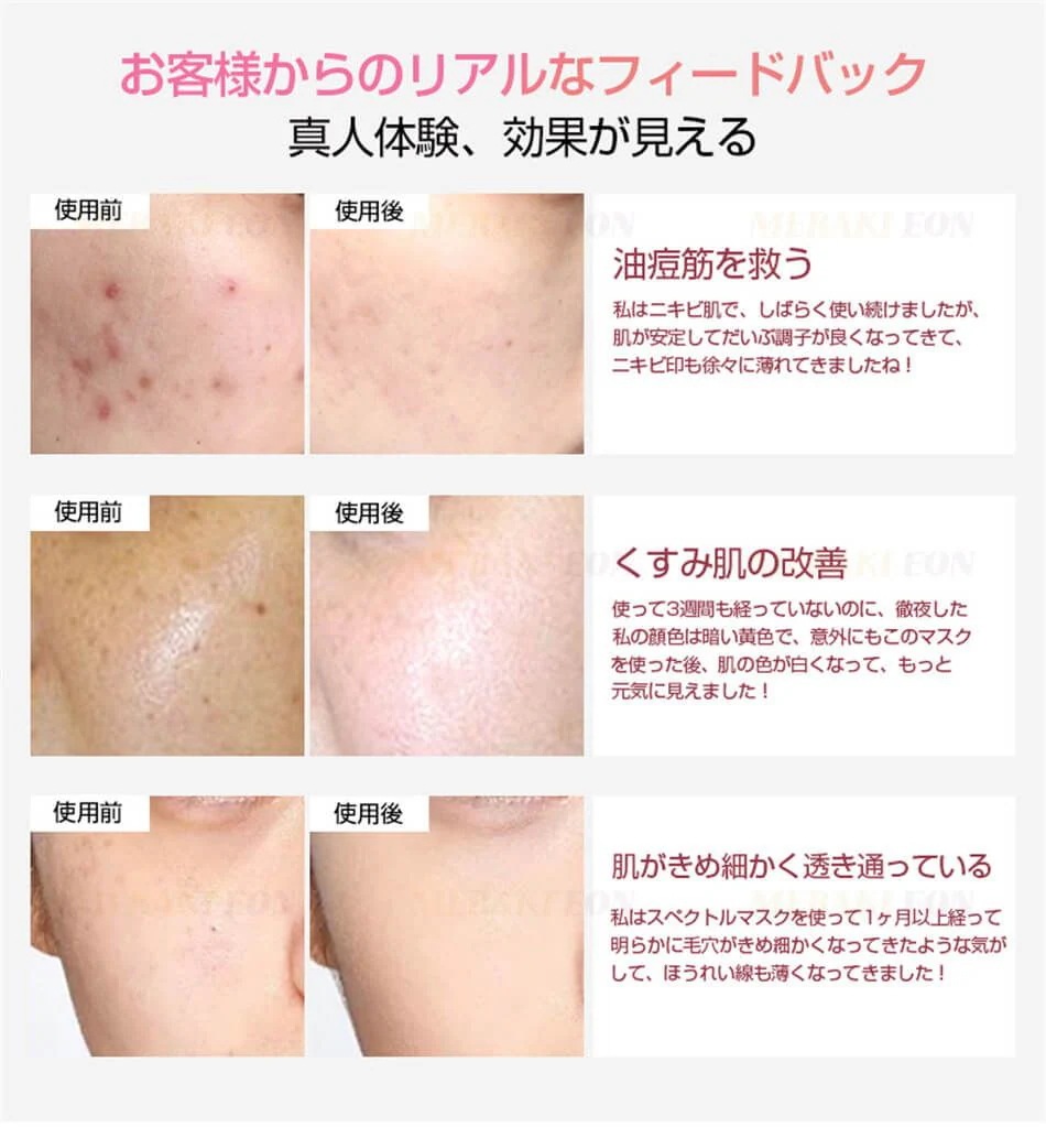 1台2役 LED美顔器 ナノ噴霧機能付き led 光 美容 美顔器 6色LED美顔器 美容器 コラーゲンマシン フォトフェイシャル スチーム美顔自宅エステ光エステ 目元ケア 首 美顔マスク LEDライ 1台2役 LED美顔器 ナノ噴霧機能付き led 光 美容 美顔器 6色LED美顔器 美容器 コラーゲンマシン フォトフェイシャル スチーム美顔自宅エステ光エステ 目元ケア 首 美顔マスク LEDライ