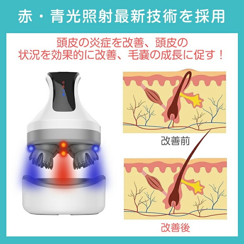 【急速出荷】頭皮マッサージャー EMS 頭皮ケア 頭皮器 電動ブラシ マッサージ機 頭皮 電動頭皮ブラシ ヘッドスパ 電気針ヘッドスパ ヘッドマッサージャー 効果 電動頭皮 頭皮エステ ストレス 【急速出荷】頭皮マッサージャー EMS 頭皮ケア 頭皮器 電動ブラシ マッサージ機 頭皮 電動頭皮ブラシ ヘッドスパ 電気針ヘッドスパ ヘッドマッサージャー 効果 電動頭皮 頭皮エステ ストレス