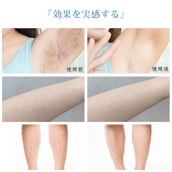 Qoo10] [安全無痛]電気シェーバー 女性用 脱毛