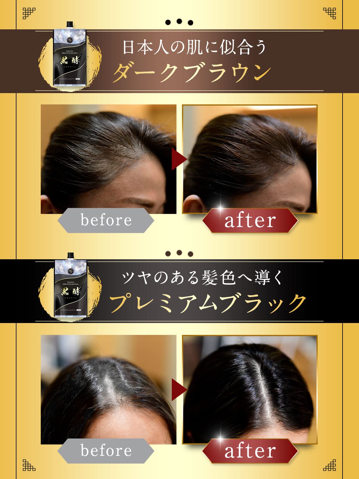 【全国送料無料】 プレミアム発酵クリームシャンプー 黒酵【1本3役】コクファ 200g 1ヶ月分 白髪用シャンプーコンディショナー白髪ケア髪と頭皮のWケア (プレミアムブラウン3個) 【全国送料無料】 プレミアム発酵クリームシャンプー 黒酵【1本3役】コクファ 200g 1ヶ月分 白髪用シャンプーコンディショナー白髪ケア髪と頭皮のWケア (プレミアムブラウン3個)