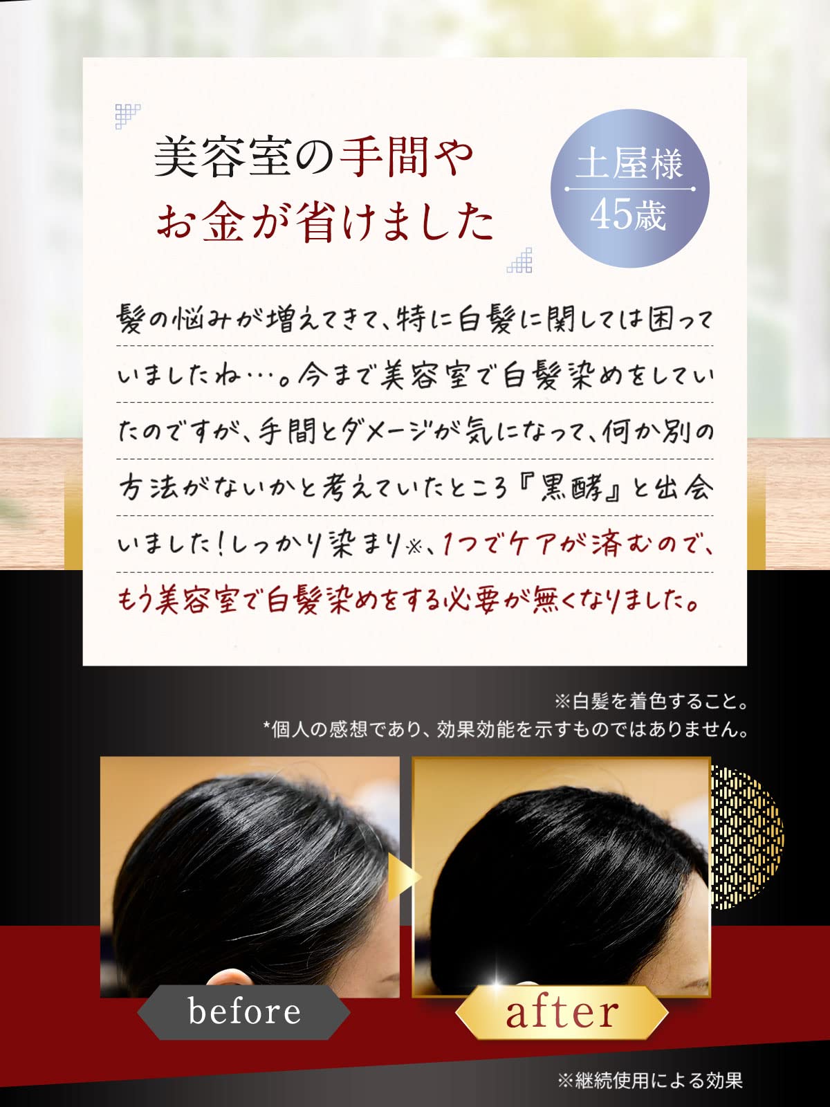 【全国送料無料】 プレミアム発酵クリームシャンプー 黒酵【1本3役】コクファ 200g 1ヶ月分 白髪用シャンプーコンディショナー白髪ケア髪と頭皮のWケア (プレミアムブラウン3個) 【全国送料無料】 プレミアム発酵クリームシャンプー 黒酵【1本3役】コクファ 200g 1ヶ月分 白髪用シャンプーコンディショナー白髪ケア髪と頭皮のWケア (プレミアムブラウン3個)