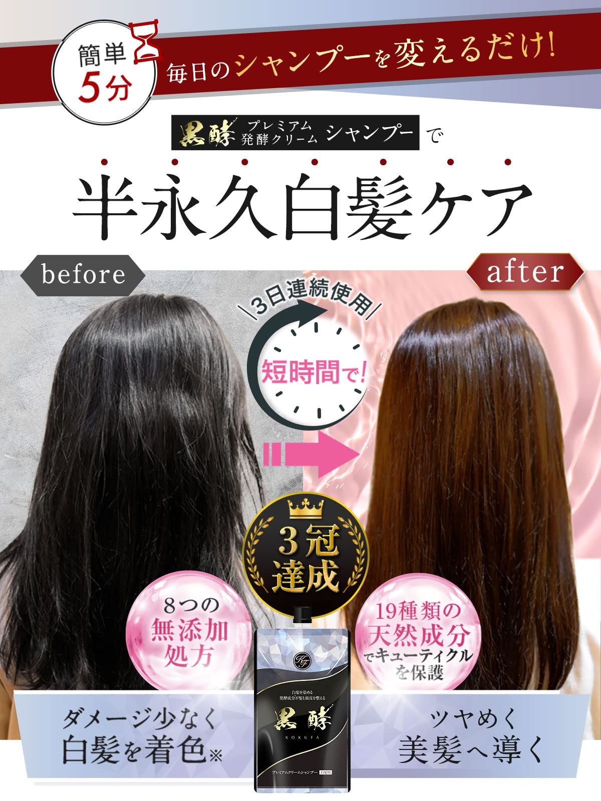 【全国送料無料】 プレミアム発酵クリームシャンプー 黒酵【1本3役】コクファ 200g 1ヶ月分 白髪用シャンプーコンディショナー白髪ケア髪と頭皮のWケア (プレミアムブラウン3個) 【全国送料無料】 プレミアム発酵クリームシャンプー 黒酵【1本3役】コクファ 200g 1ヶ月分 白髪用シャンプーコンディショナー白髪ケア髪と頭皮のWケア (プレミアムブラウン3個)