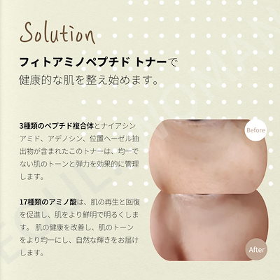 まーちゃんさま　セルマン　フィトアミノペプチドトナー Qoo10] SERMENT 【韓国の美容皮膚科医オススメ！】セルマン