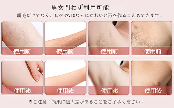 Qoo10] レーザー脱毛器 IPL光脱毛器 光美容器