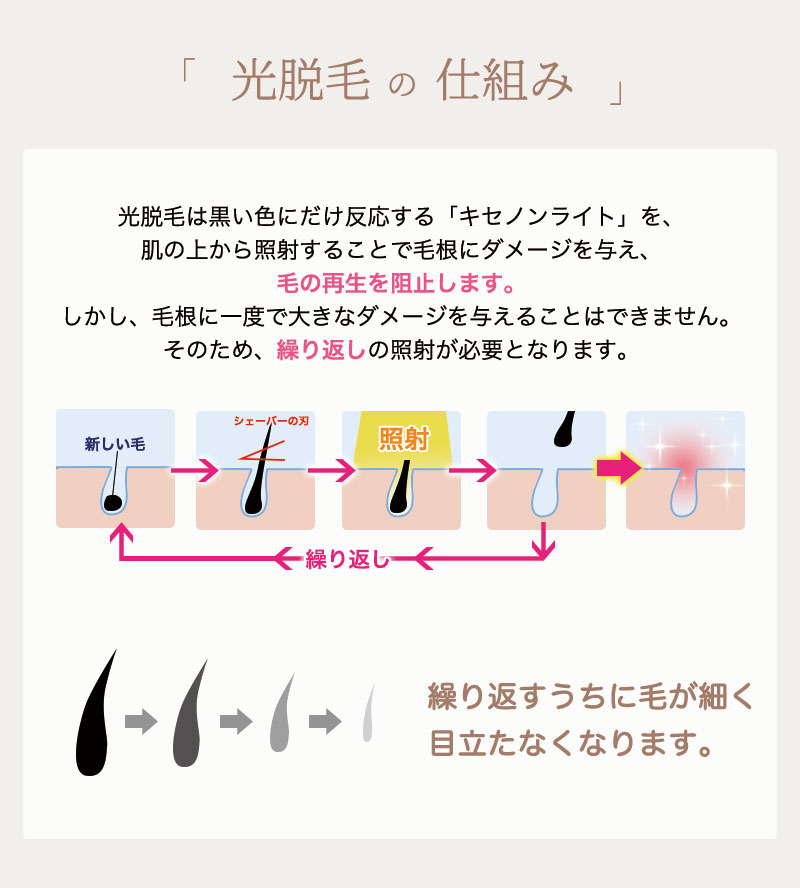 脱毛器 フラッシュ脱毛器 美肌 冷却 無料1年保証 レビュー特典付き 40万回照射可能 家庭用光脱毛 脱毛器 フラッシュ脱毛器 美肌 冷却 無料1年保証 レビュー特典付き 40万回照射可能 家庭用光脱毛