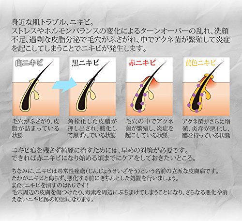 温熱ラジオ波 美肌 光エス... : ダイエット・矯正 RF 美顔器 最新品人気
