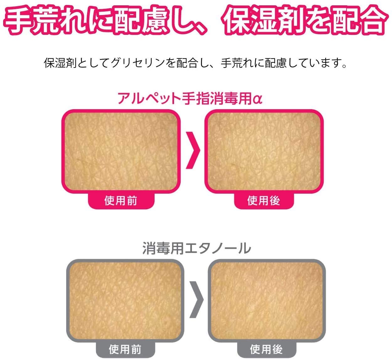 アルペット手指消毒用α 5L カップ&ノズルコック付 指定医薬部外品 アルペット手指消毒用α 5L カップ&ノズルコック付 指定医薬部外品