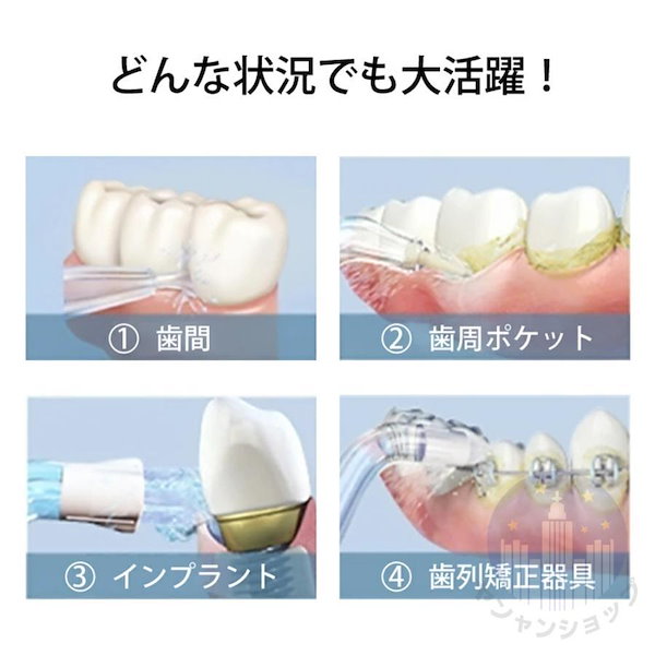Qoo10] 口腔洗浄器 歯垢除去 口腔洗浄機 ジェッ