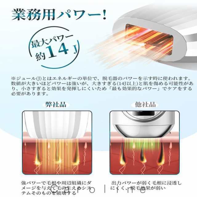 脱毛器 IPL光脱器 永久脱毛 家庭用脱毛器 自動照射 レーザー vio対応 メンズ レディース 脇 腕 足 背中 全身用 LED液晶 全身適用44 脱毛器 IPL光脱器 永久脱毛 家庭用脱毛器 自動照射 レーザー vio対応 メンズ レディース 脇 腕 足 背中 全身用 LED液晶 全身適用44