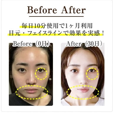 ＊新品・未使用＊ エルフェイス エー 美顔器 EMS目元ケア コードレス 楽天市場】エルフェイス ELFACE 韓国 最新 美顔器 ジェル不要 簡単操作