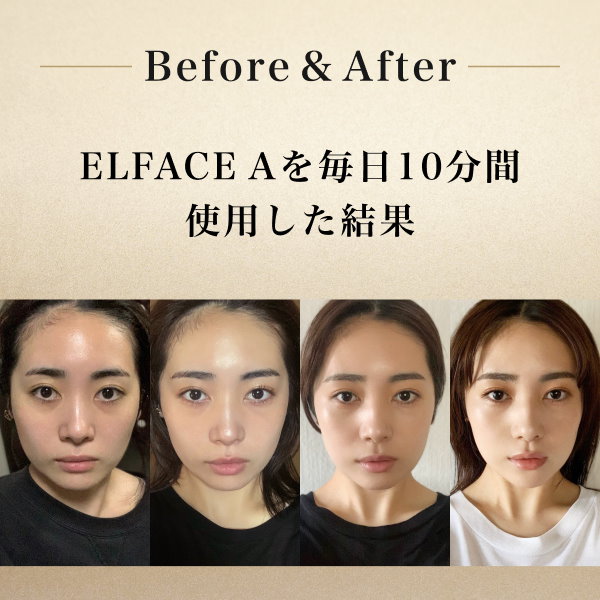 ELFACE エルフェイス 美顔器 韓国 - 美容機器