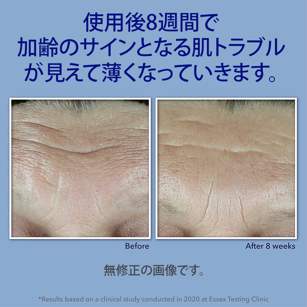 【エクスプレス便】RoC Retinol Correxion Max Daily Hydration Daily Face Moisturizer 1.7oz レチノール・ヒアルロン酸配合クリーム 【エクスプレス便】RoC Retinol Correxion Max Daily Hydration Daily Face Moisturizer 1.7oz レチノール・ヒアルロン酸配合クリーム