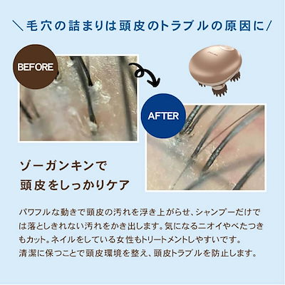 Qoo10] ZOGANKIN 【正規販売店】ゾーガンキンスカルプ EM : 美容