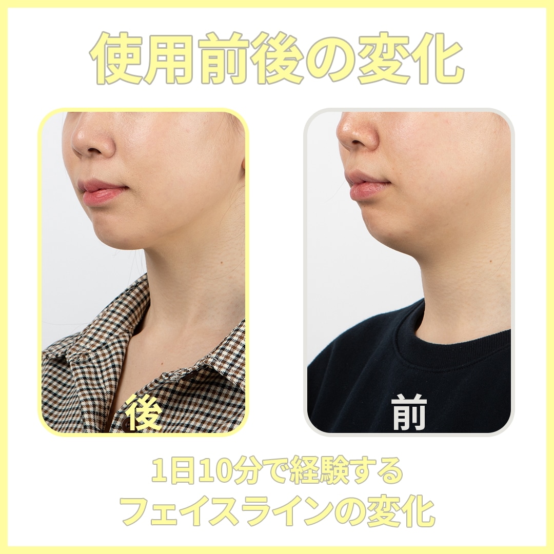 Qoo10] DAILY WONDER 【小顔美顔器】ミーブイングタングトレーナ