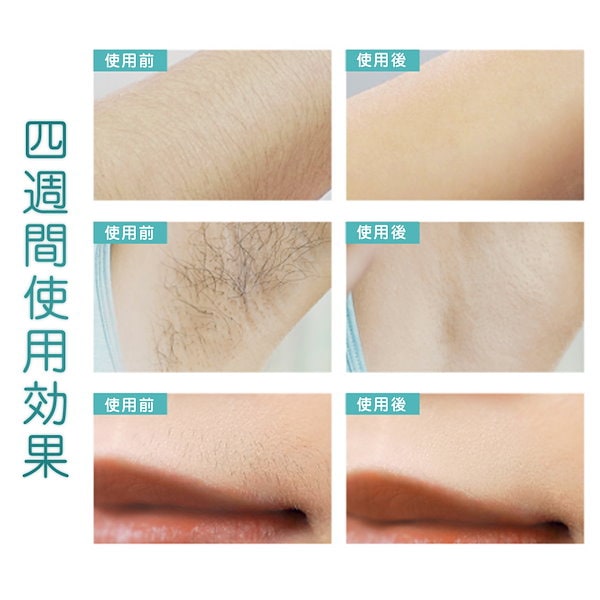 Qoo10] TAQISONG 脱毛器 脱毛 IPL光脱毛器 無痛脱毛