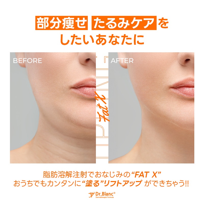 【ランキング入り/韓国ダイエット新定番】［ファットエックスアッピングクリーム 100ml（1+1）］脂肪分解/脂肪燃焼クリーム/脂肪溶解/シェイプアップ/デオキシコール