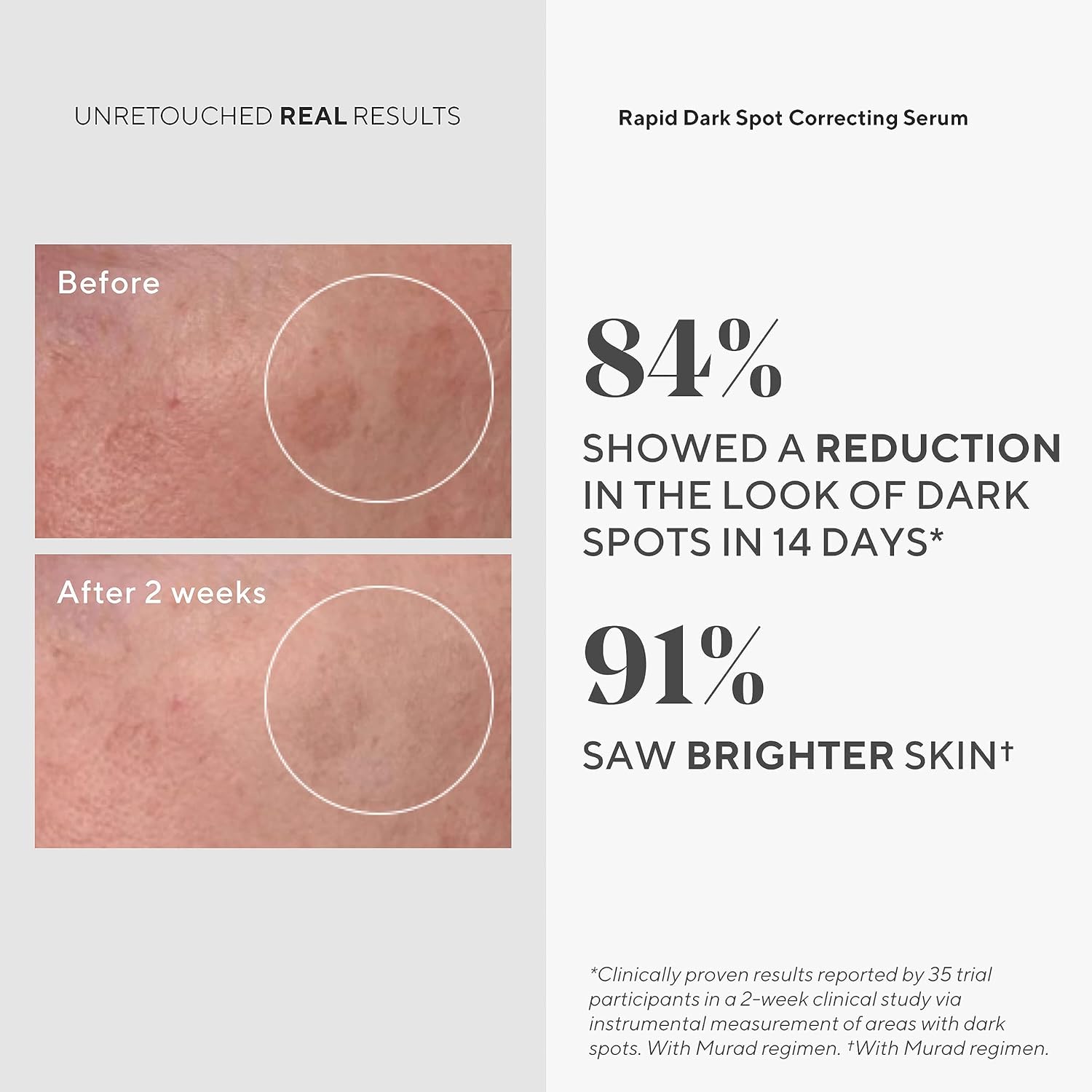 Murad Brighten Trial Kit 4ピースのトライアルサイズキット $94の価値 - ブライトニングスキンケアキット - Essential-C CleanserEssentia