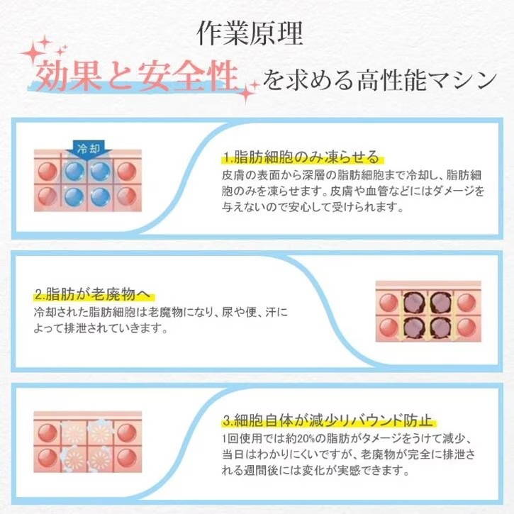 ダイエット冷凍キャビテーションマシン 腕 腰 太もも 腰 脚 痩身ボディマシン 脂肪冷却 簡単便利 ダイエット冷凍キャビテーションマシン 腕 腰 太もも 腰 脚 痩身ボディマシン 脂肪冷却 簡単便利
