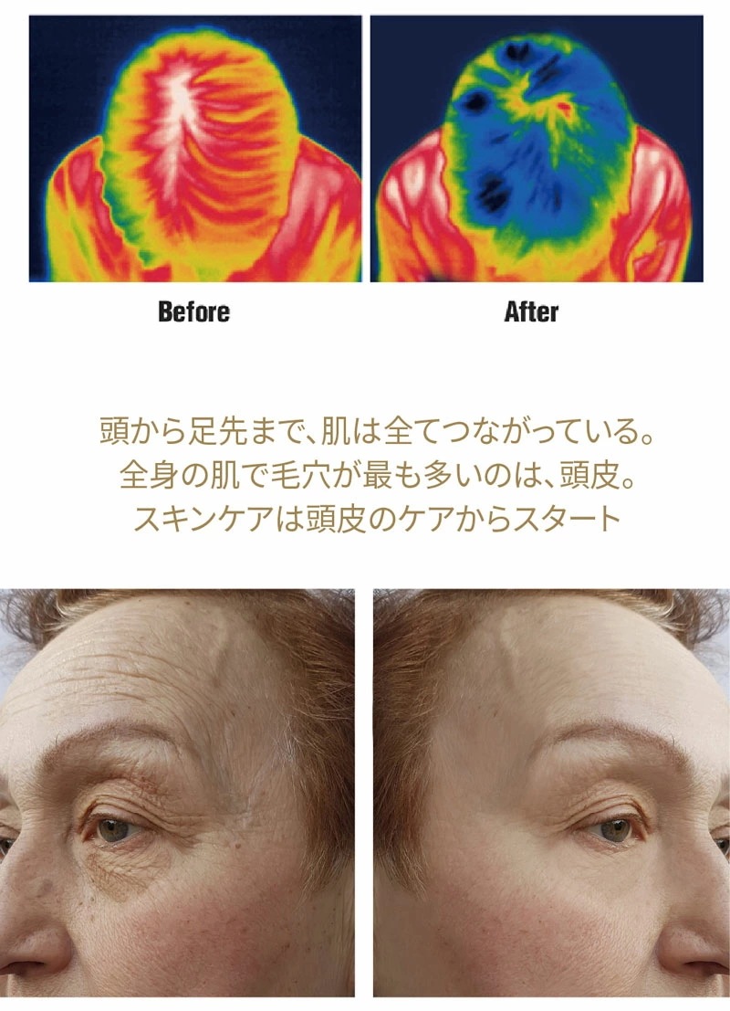 (2個セット) SallyZen ボリューマイジング ＆ スーディング トニック 100ml tenko 頭皮 サロン 美容 レディース 女性 におい 乾燥 (送料無料) あす楽