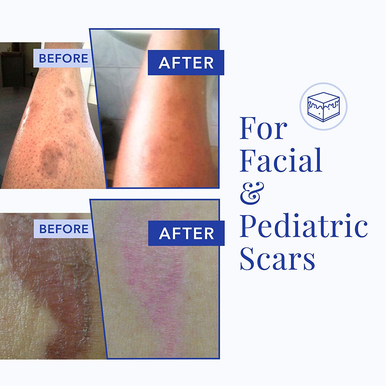 [アメリカプレミアム商品]リジュバスキン傷跡エステティクシリコン入りスカークリーム-23の有効成分