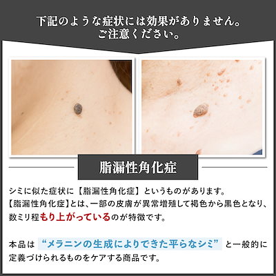 galcia - シミしみさん専用 Qoo10] cosmejitan 医薬部外品 シミ取りクリーム パック シ