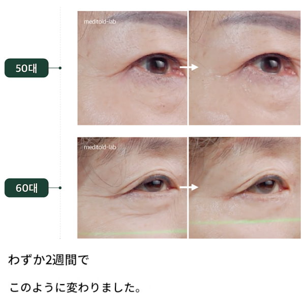 Qoo10] meditold アクシークリーム AACIクリーム 20
