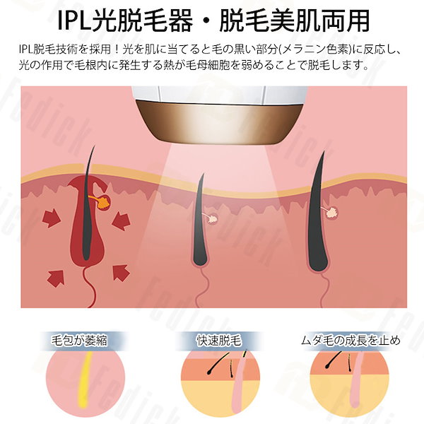 Qoo10] IPL光脱毛器 光脱毛器日本語取扱説明書