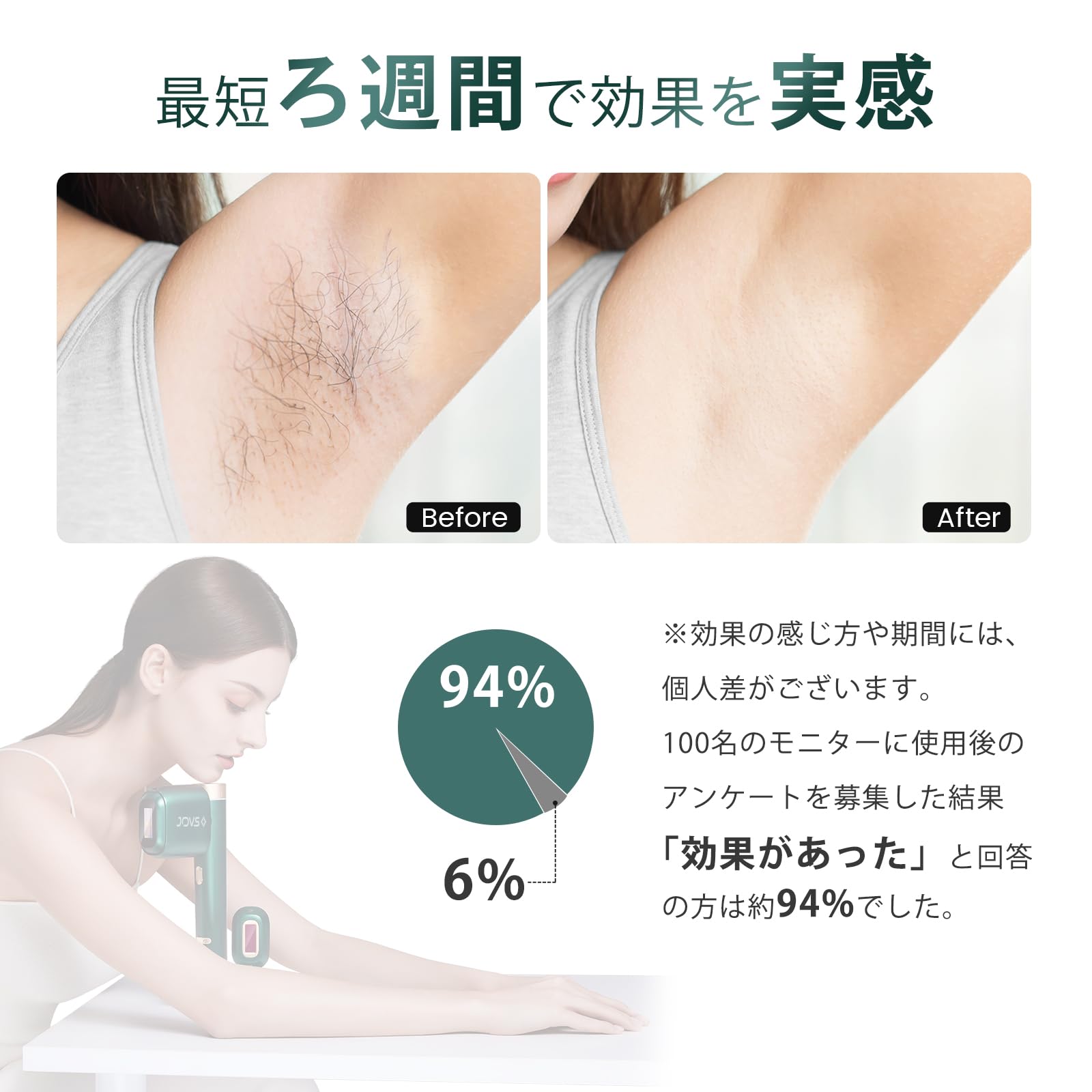 Qoo10] JOVS JOVS 脱毛器 メンズ レディース v