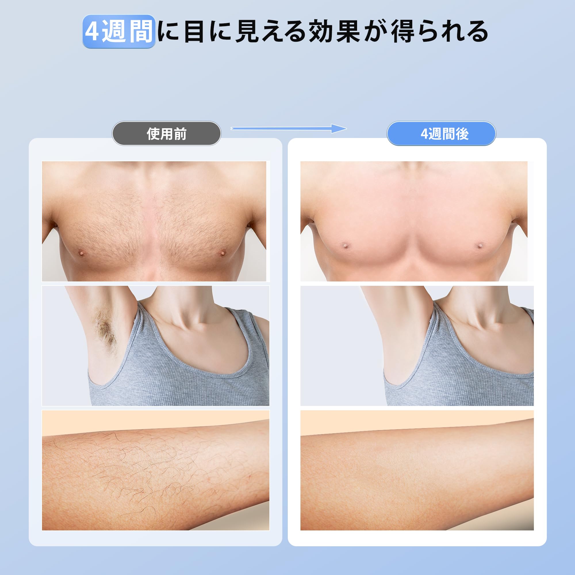 YUNDOO 脱毛器【サロン級冷感脱毛器】 IPL光脱毛器 メンズ 髭 レディース VIO対応 9段階調節 19.8J高出力 99万回照射 自動/手動照射モード だつもうき脱毛器 顔 髭 脇 腕 足用 YUNDOO 脱毛器【サロン級冷感脱毛器】 IPL光脱毛器 メンズ 髭 レディース VIO対応 9段階調節 19.8J高出力 99万回照射 自動/手動照射モード だつもうき脱毛器 顔 髭 脇 腕 足用