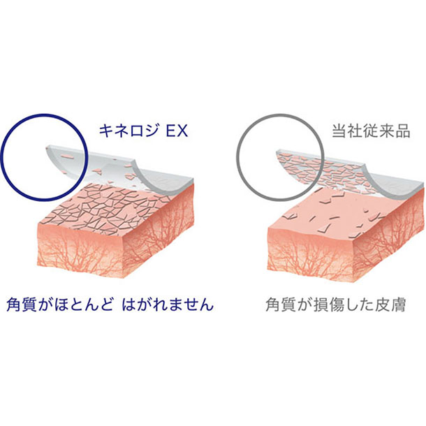 ニトリート NITREAT キネロジ EX テーピング用品 (NKEX25)