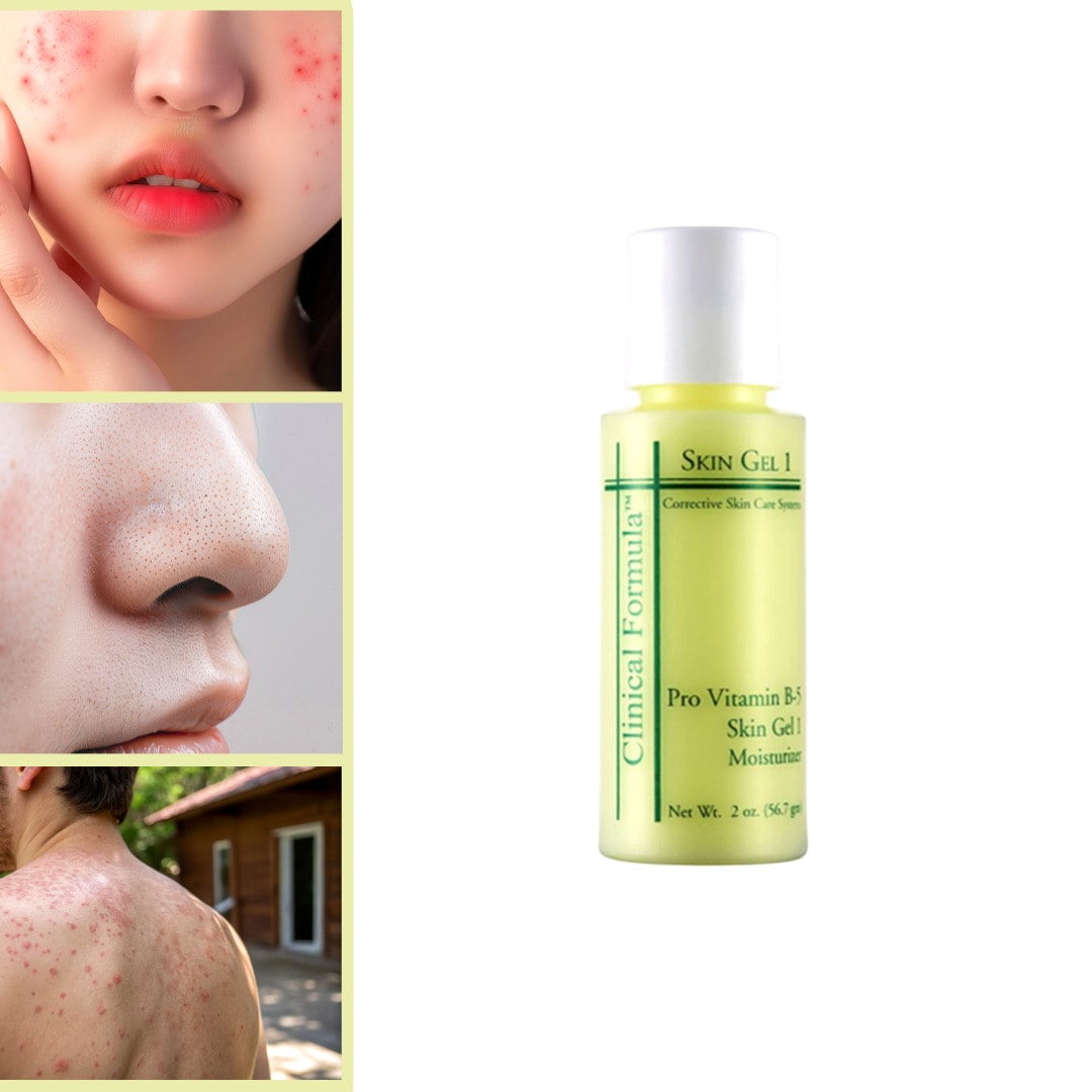 Clinical Formula Pro Vitamin B5 Skin Gel 1 60ml [トラブルスポット,ブラックヘッド,ホワイトヘッド,背中/胸にきび]