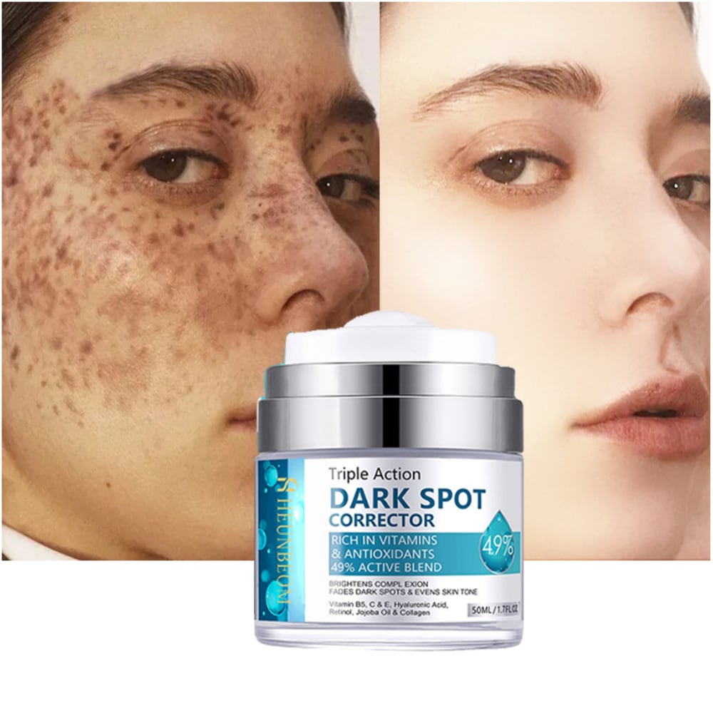 シミの除去 シミクリーム クリーム きのこ グラブスキン修復 シミクリーム50ml2個