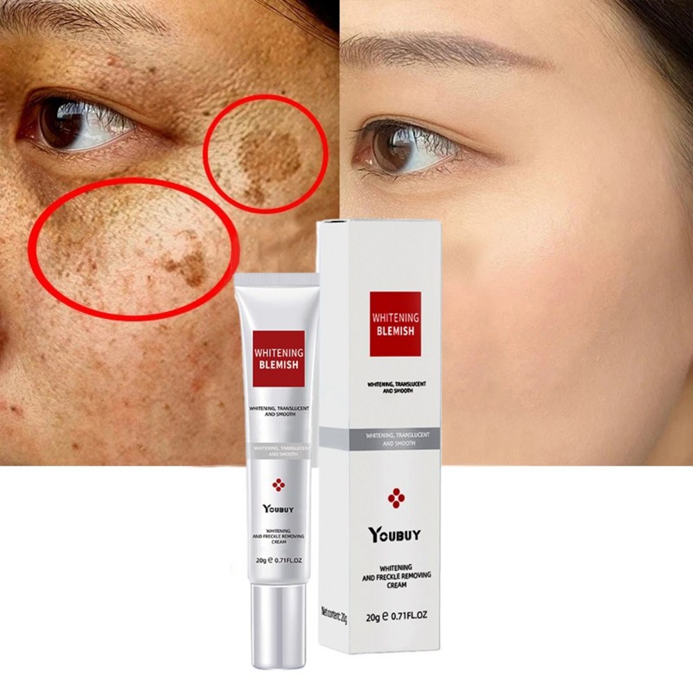 色素沈着ダークスポット除去顔クリーム20g2個 , 年末行事, 催し. イベント2+2イベント実施, 2つので計4個のご提供