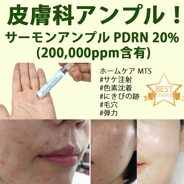 Qoo10] Olive Young サーモンアンプル PDRN 20% 20