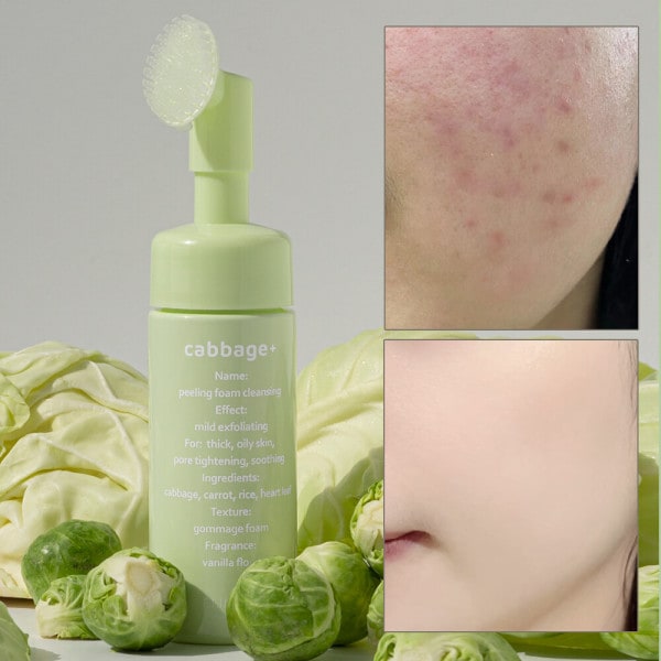 キャビッジ ピーリング 顔角質除去 フォームクレンジング 150ml 5,015円