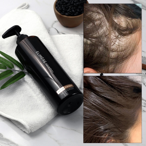 セーブ毛脱毛症シャンプー 脂性シャンプー 脂漏性頭皮炎 500ml