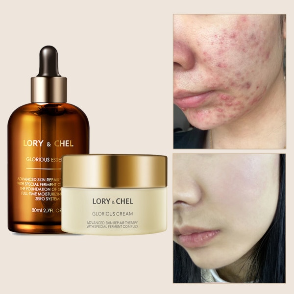 ローリアンチェル グローリアス 水分クリームエッセンスセット