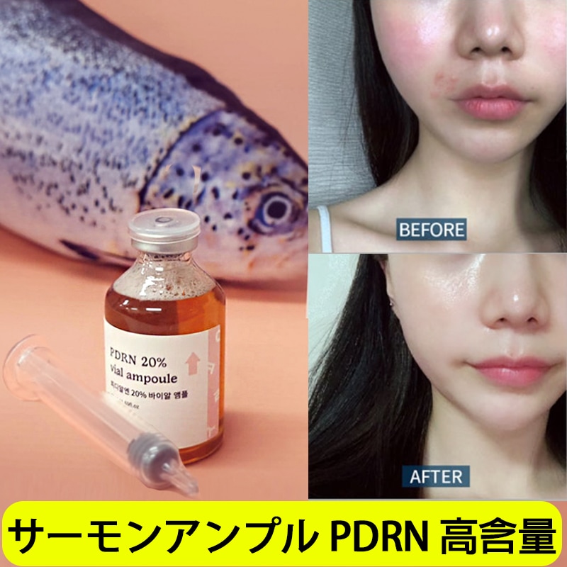 サーモン注射 pdrn セラム 高含量 ニキビ跡 色素沈着 リジュラン注射 booster shot オリーブヤング サーモンアンプル ニキビ跡 リドルショット 導入 美容液 毛穴注射 韓国コスメ 4,968円