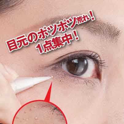 【お得!６個セット】薬用ツブクリン プレミアム 【目元ポツポツ　首元角質　集中ケア　薬用ジェル　はとむぎ配合　ペンシルタイプ　ピンポイント ジェル ペン 医薬部外品】