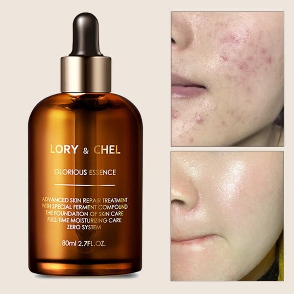 ローリアンチェル グローリアス エッセンス アンプル セラム 80g