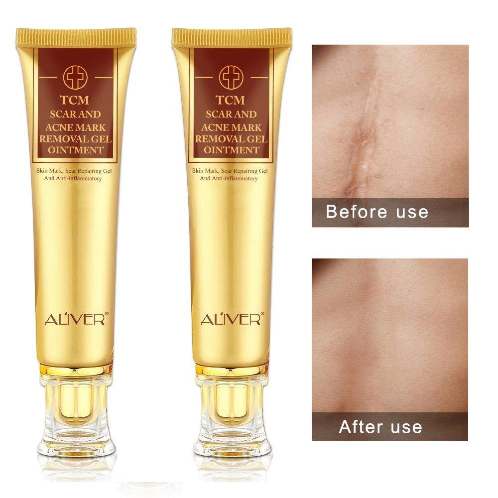 2 pack Aliver TCM Scar and Acne Mark Removal Gel C