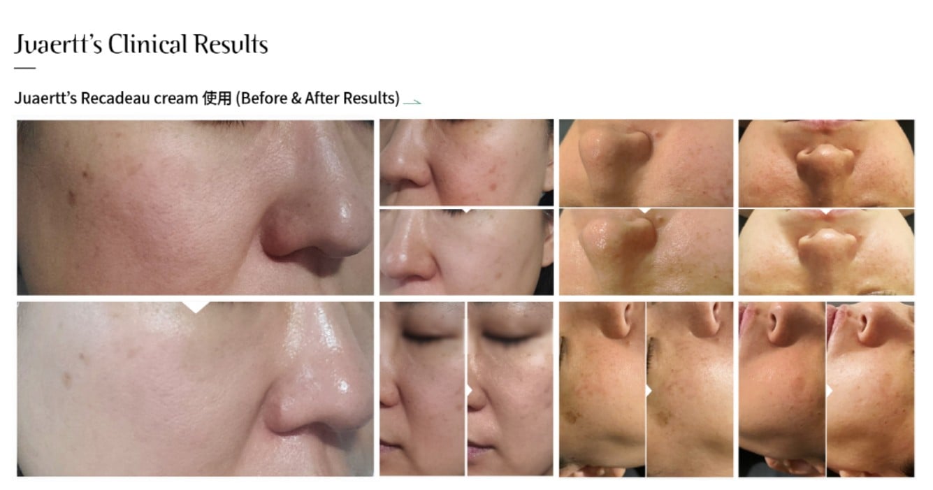 公式(official).ジュエルテ リカド クリーム 保湿・乾燥小じわ対策 70g_肌荒れ防止＋高保湿 韓国コスメ リカド クリーム