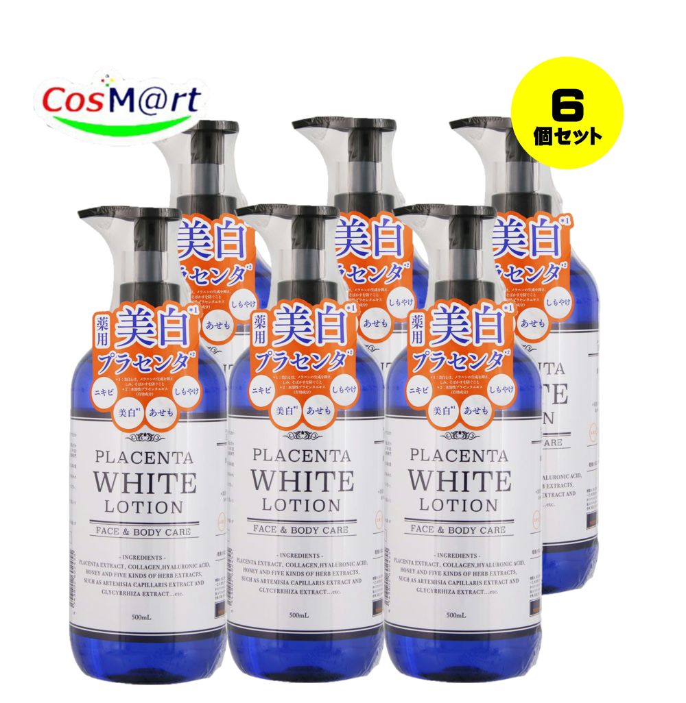 【6個セット】 【医薬部外品】 健美舎 エーフォルム 薬用プラセンタローション 500mL (4543802602455-6)