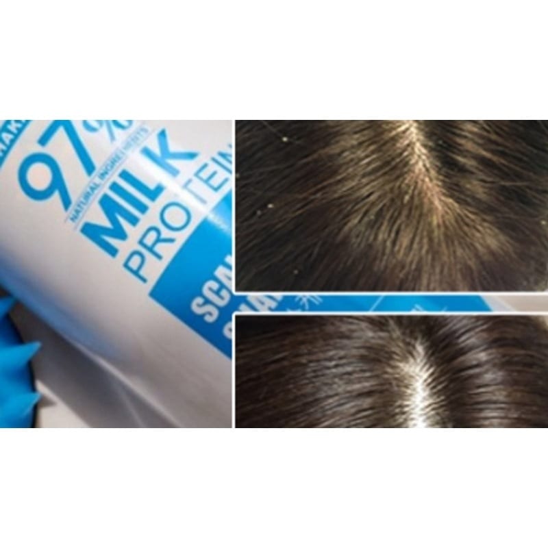 優れたファクトリーフケかゆみ角質除去ミルクタンパク質頭皮スケーリングシャンプー1000ml