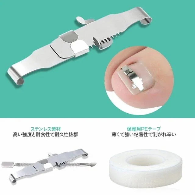 1つ買うと10個無料テープ 足の巻き爪 爪ブロック テーピング ワイヤー 防止 矯正 巻爪 サポーター ガード 巻きづめ