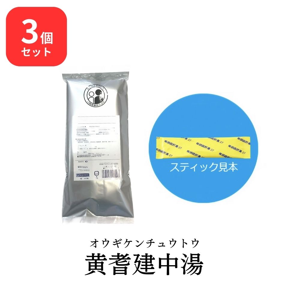 【第2類医薬品】【3個セット】 松浦薬業 黄耆建中湯 オウギケンチュウトウ 30包 × 3 (90包) エキス 細粒 76 松浦漢方 マツウラ 虚弱体質 病後の衰弱 ねあせ