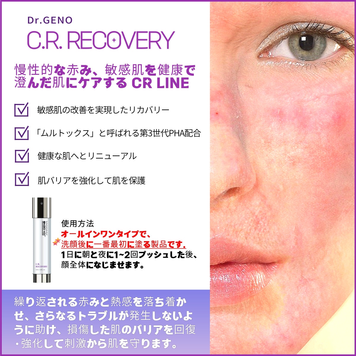 Dr.GENO C.R. RECOVERY 50ml, 赤みの緩和に効果的なオールインワンクリーム(化粧水+ローション+エッセンス)