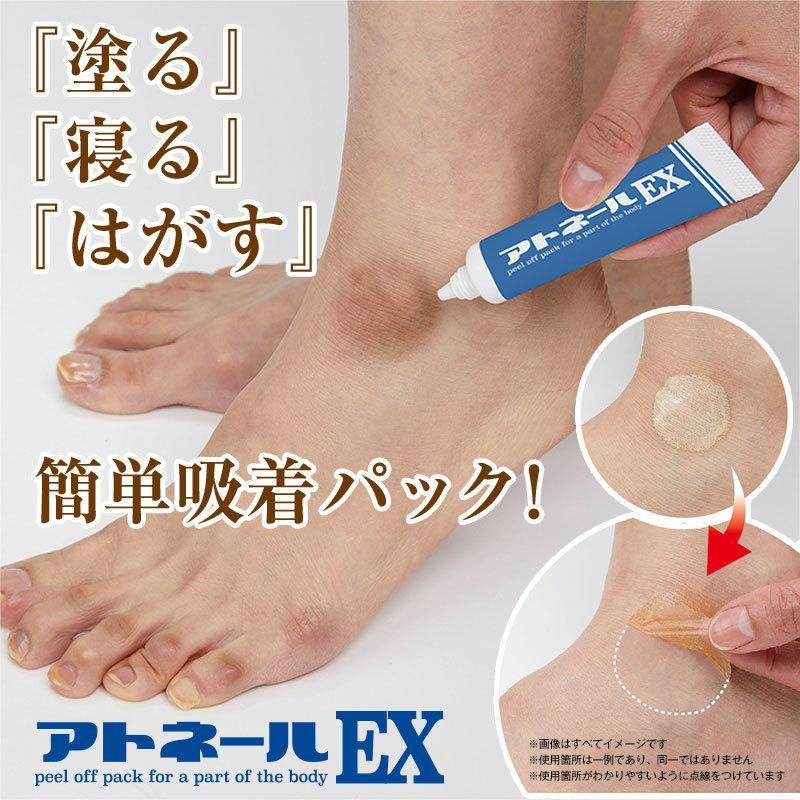 Qoo10] 【アトネールEX 15g 】足の角質ケア