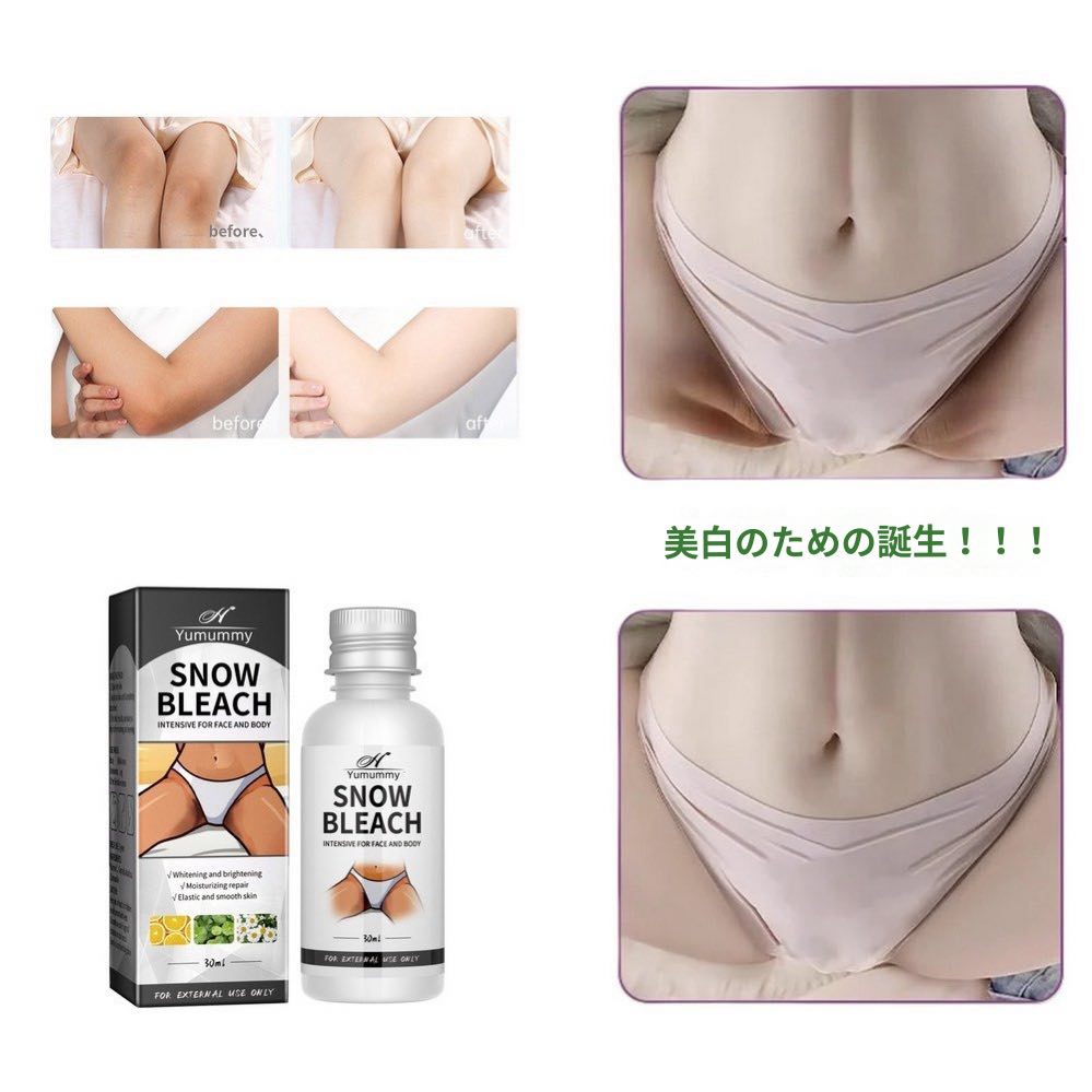 メラノンクリーム メラトーニングクリーム 脇 色素沈着 色素沈着軟膏 メラニン抑制30ml 4個 5,060円