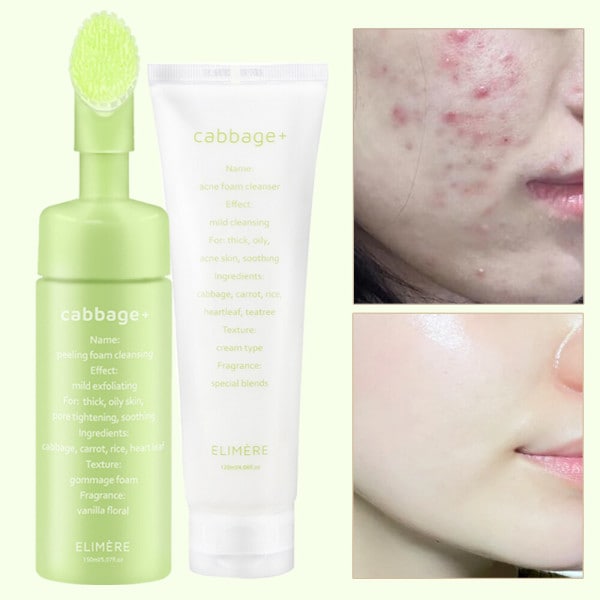 キャビッジアクネトラブルケアセット（ピーリング+クレンザー）